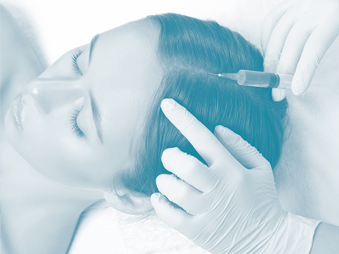 exosome hair restoration therapy London