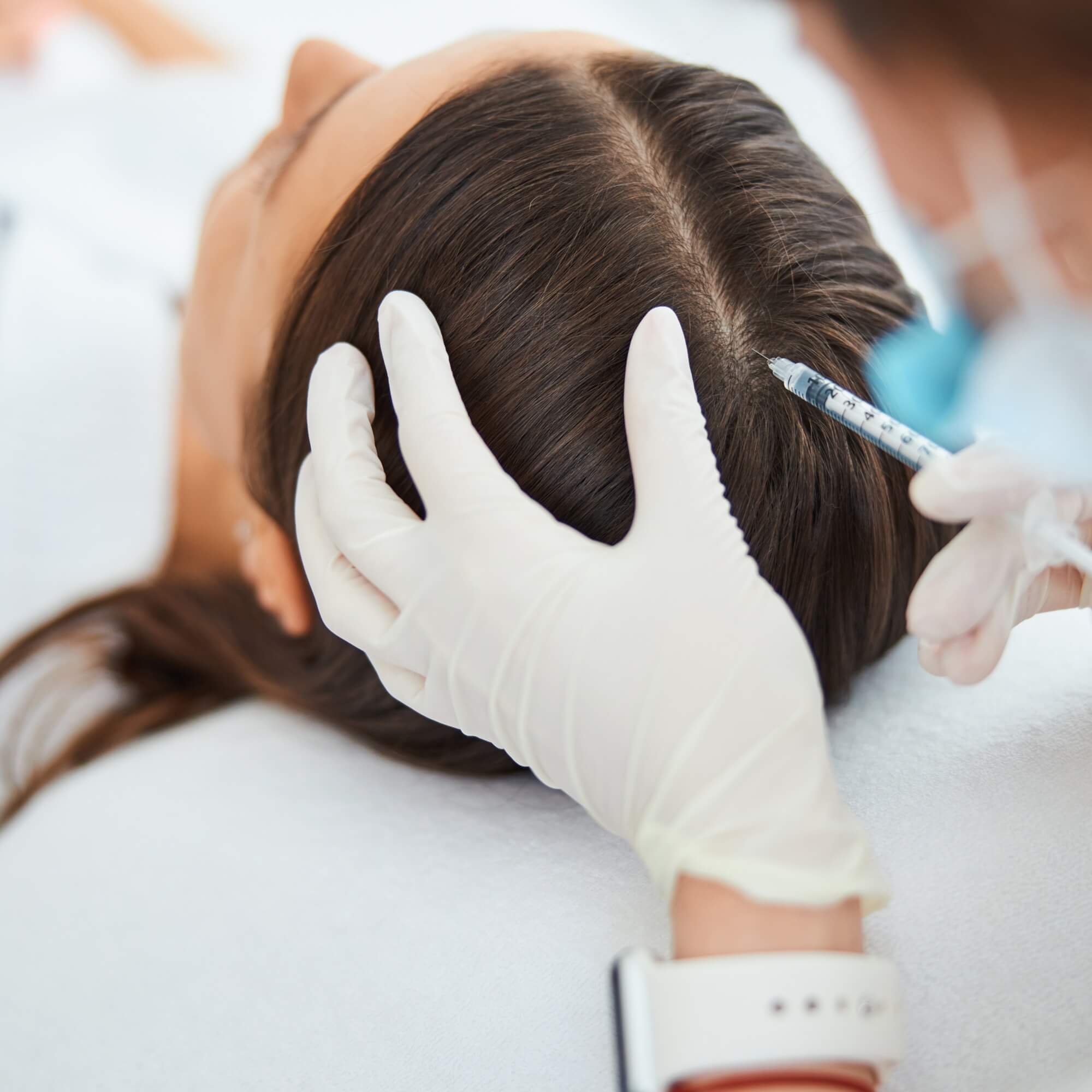 exosome hair restoration therapy London