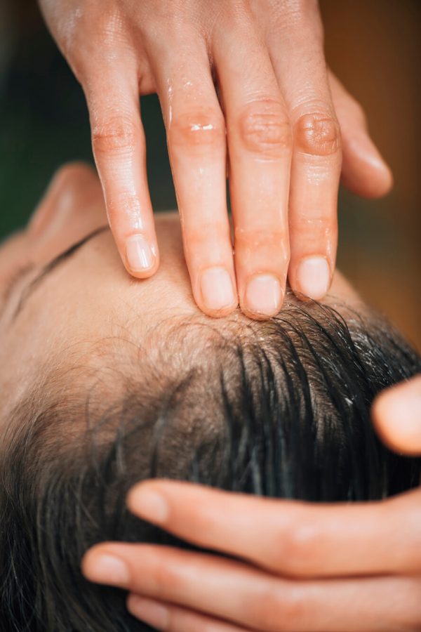 prp-hair-treatment-04